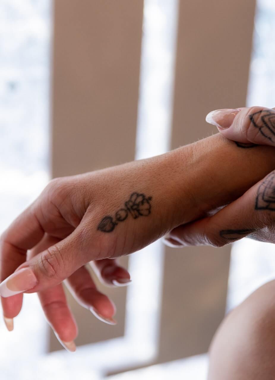 laser tattoo removal process